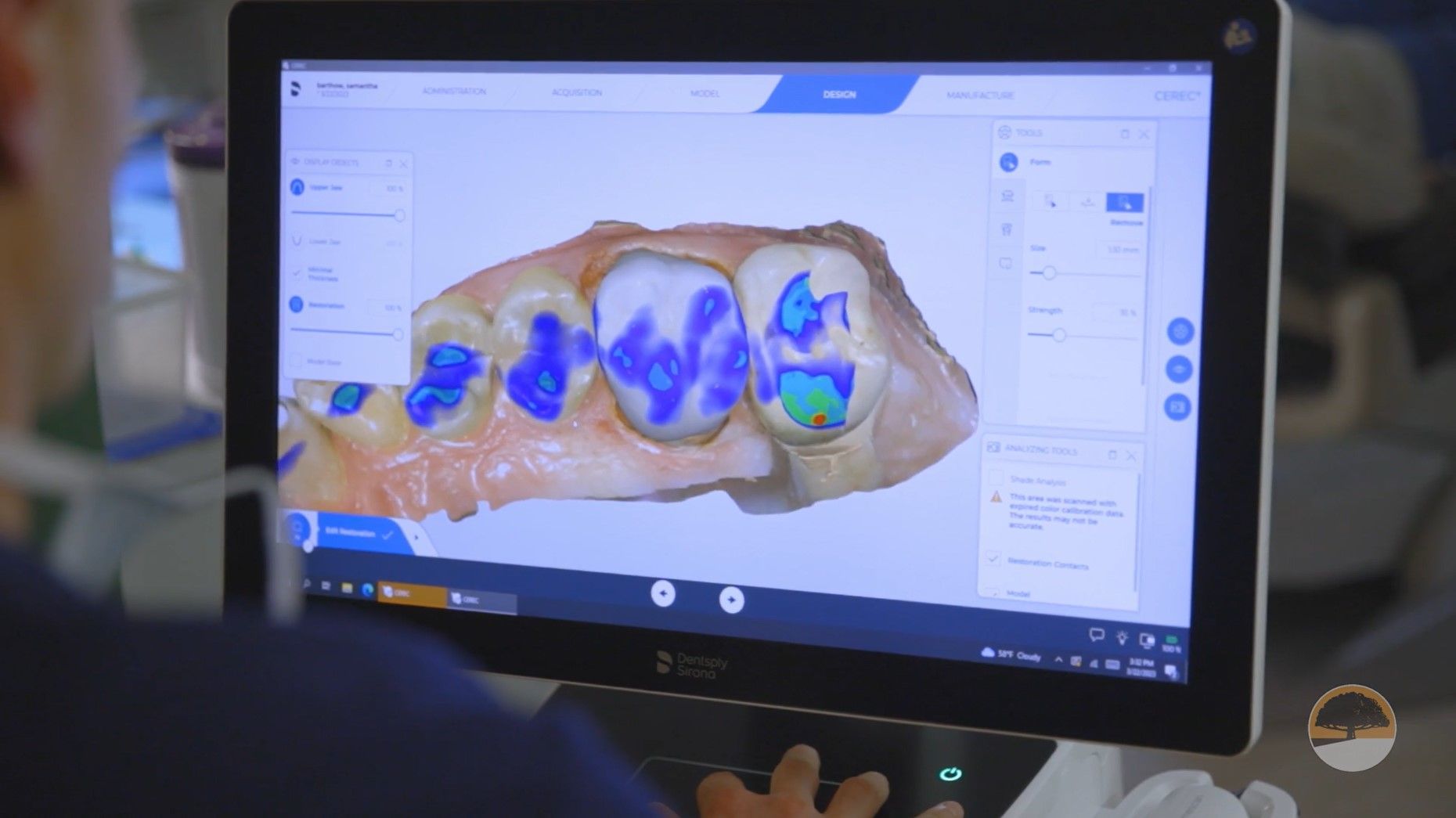 A man is looking at a computer screen with a picture of teeth on it.