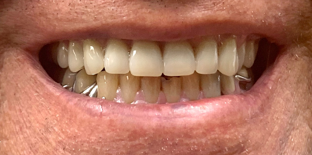 good dental results