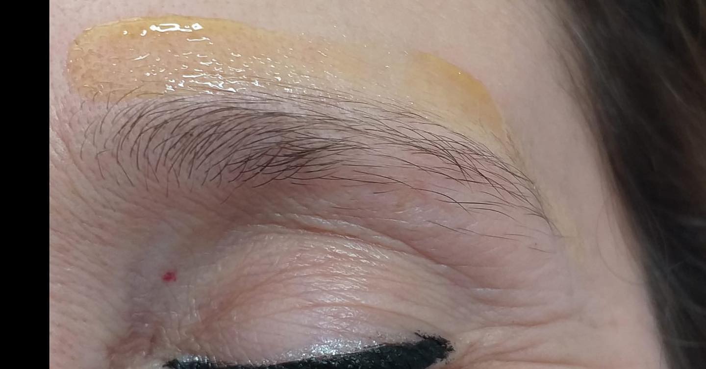 Sopracciglia diradate