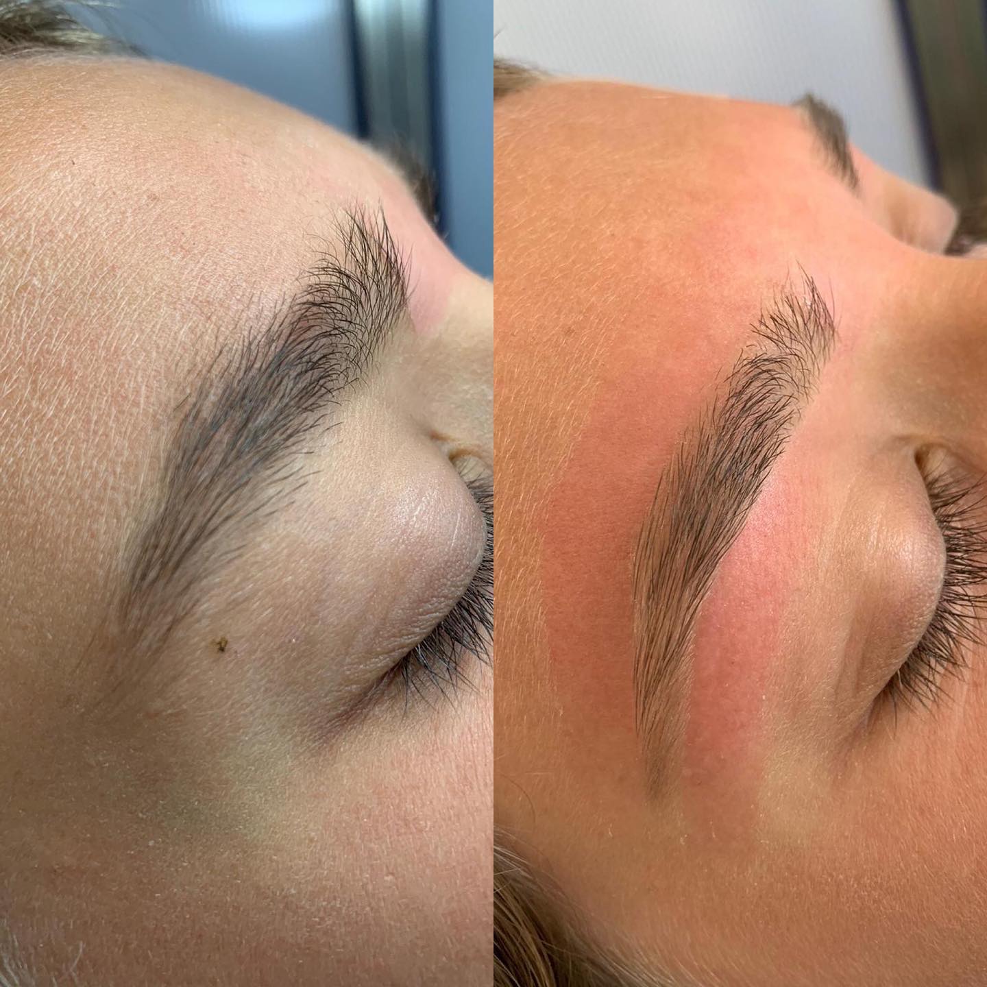 Rinfoltimento sopracciglia