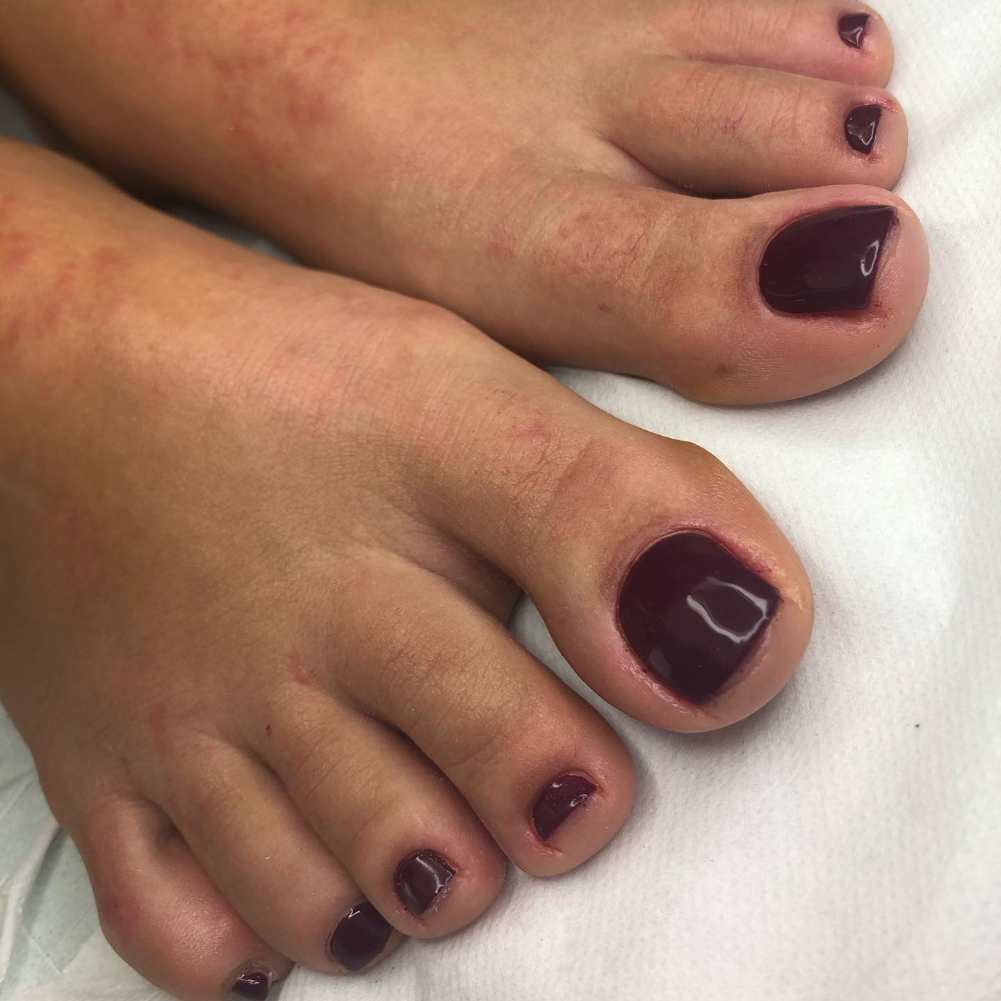 semipermanente piedi