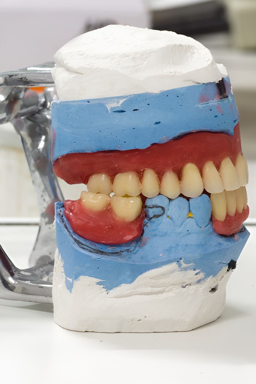 A Model of a Person 's Teeth is Sitting on a Table — Buderim Denture Studio in Buderim QLD