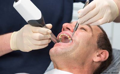 Digitale Aufnahme der Zähne statt Abformung
