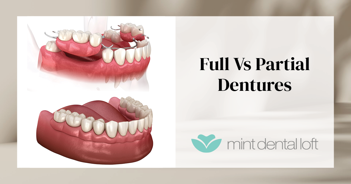 The Difference Between Full and Partial Dentures