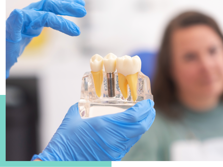 A dentist is holding a model of a dental implant in front of a woman