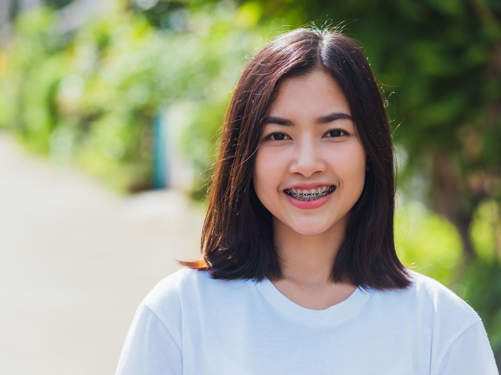 An image of a young Asian girl with braces standing outside