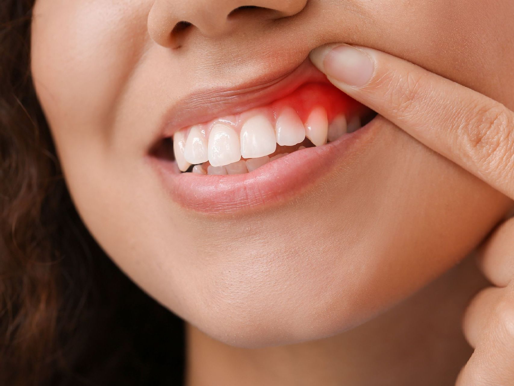 A close up of a woman's teeth with a red area indicating tooth pain