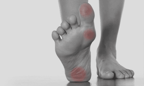 relief from bunion pain