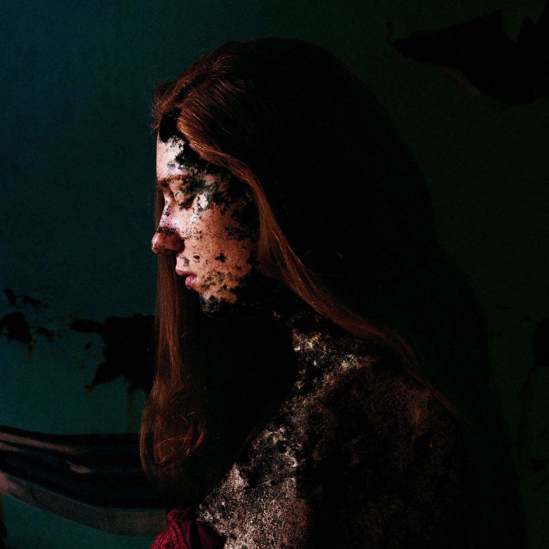 A woman with a lot of spots on her face is standing in the dark.