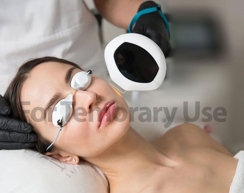 Woman undergoing laser eye treatment, wearing protective goggles; technician holds a light shield.
