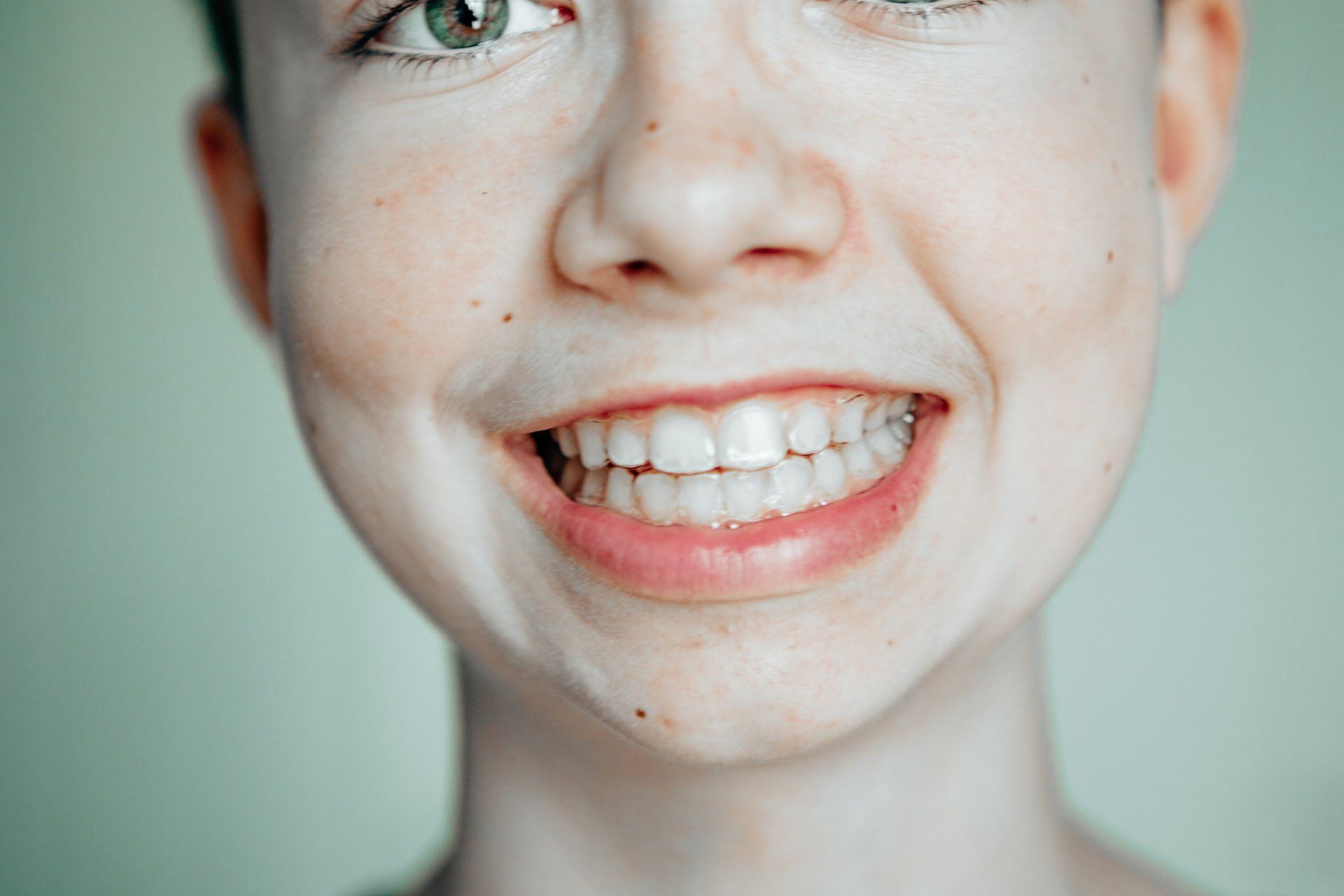 Wearing Invisible Dental Aligner | Johnston, IA | Johnston Family Dentistry