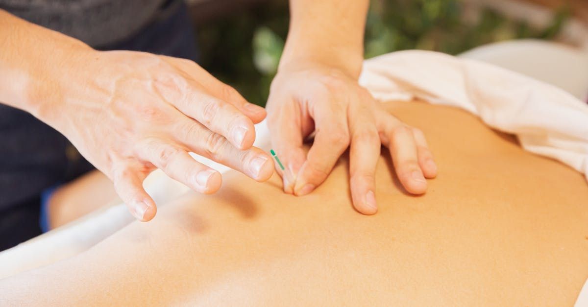 A person is getting an acupuncture treatment on their back.