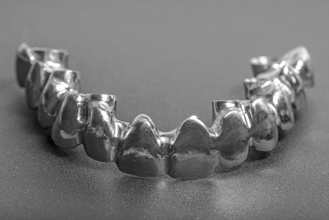 realizzazione protesi dentale in Titanio