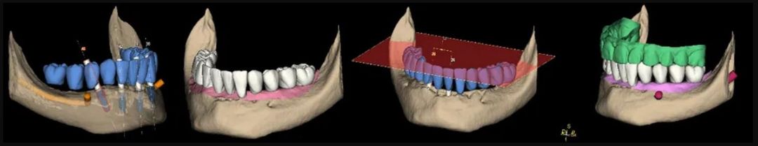 visuale denti con software Arco SynSurgery