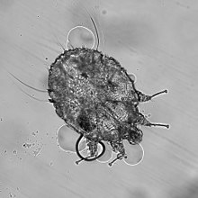 scabies mite under microscope