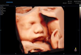 Una mujer embarazada sostiene una foto de su bebé en sus manos.
