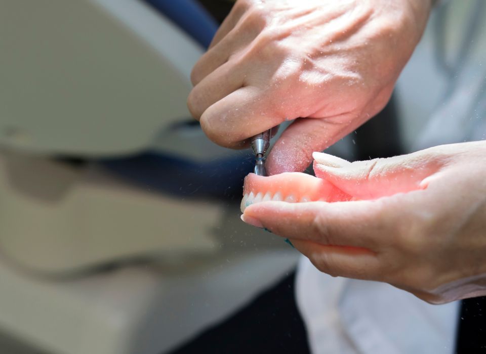 Dental technician using a tool to work on a set of dentures with attached implants.
