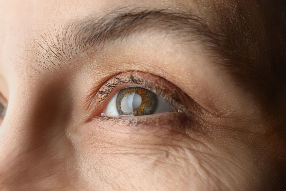A close up of a woman 's eye with wrinkles