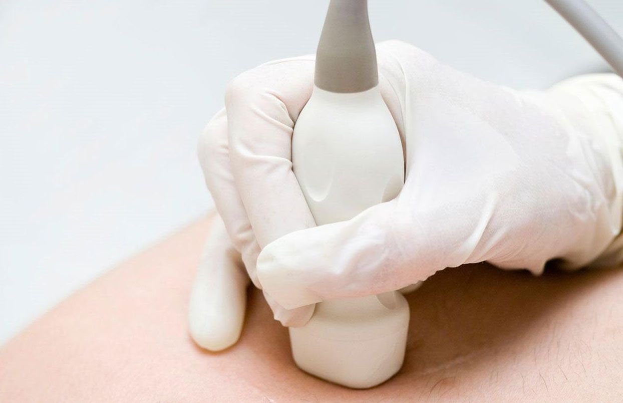 CEULDI - Servicio  de ultrasonido Abdomen superior