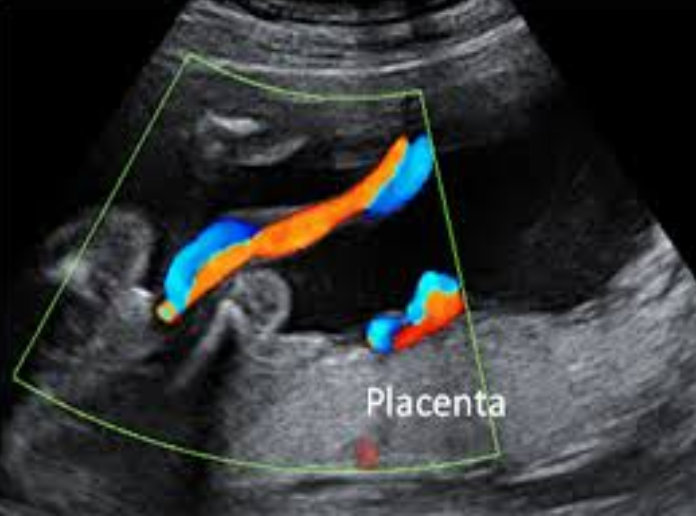 ¿QUÉ ES EL PERFIL BIOFÍSICO FETAL?