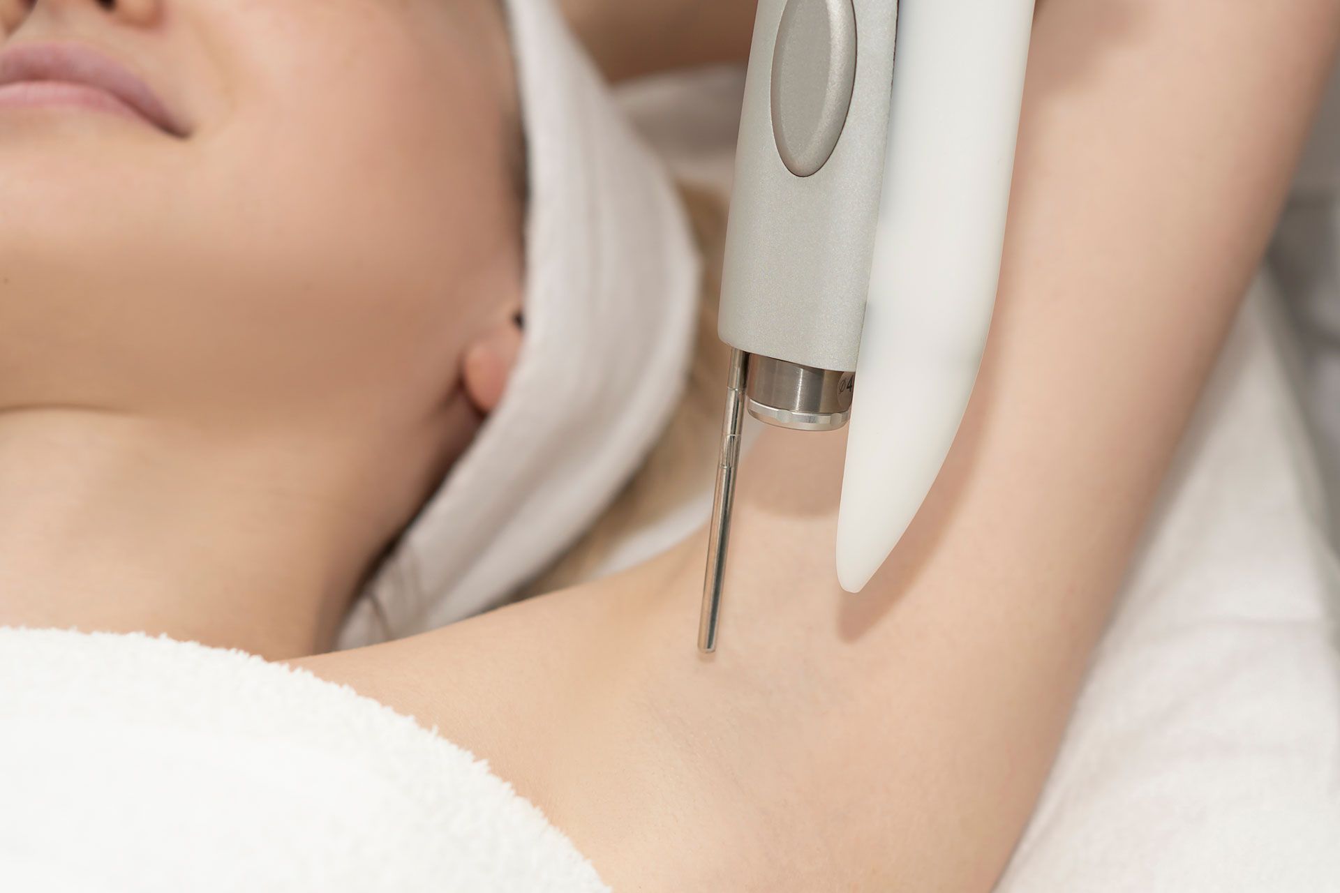 Person receiving laser hair removal treatment on armpit.