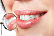 clear tooth gem