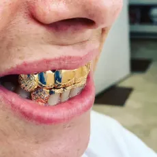 Gold top grill