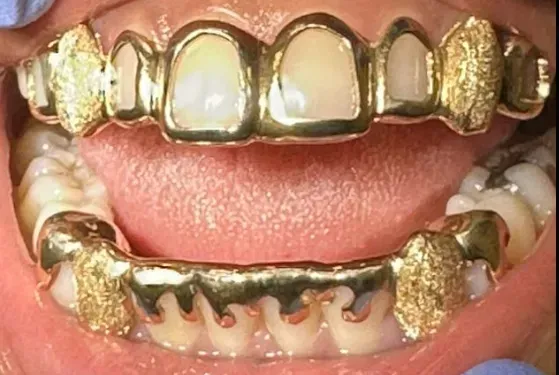 personalized gold grill