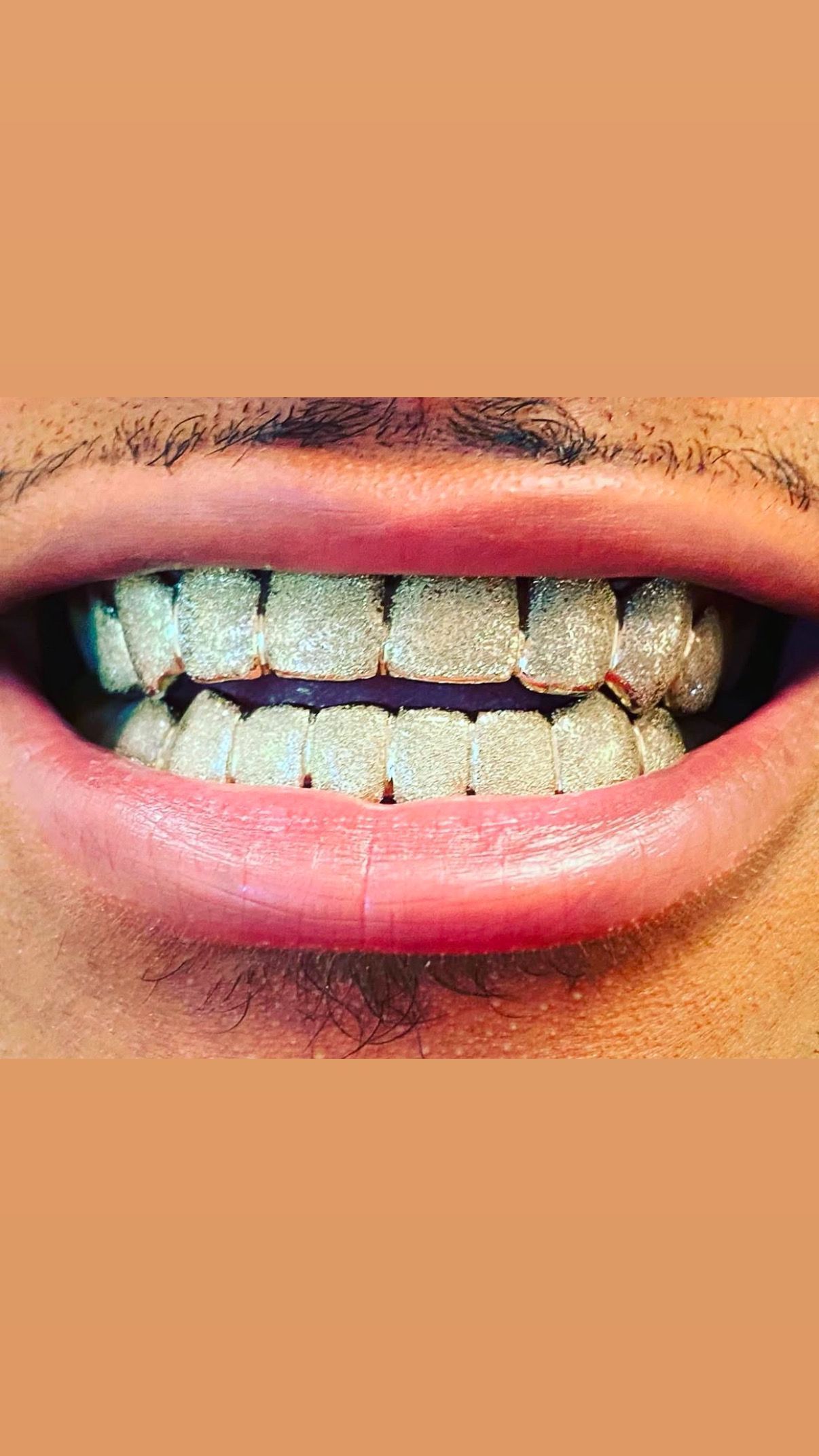 silver grill custom