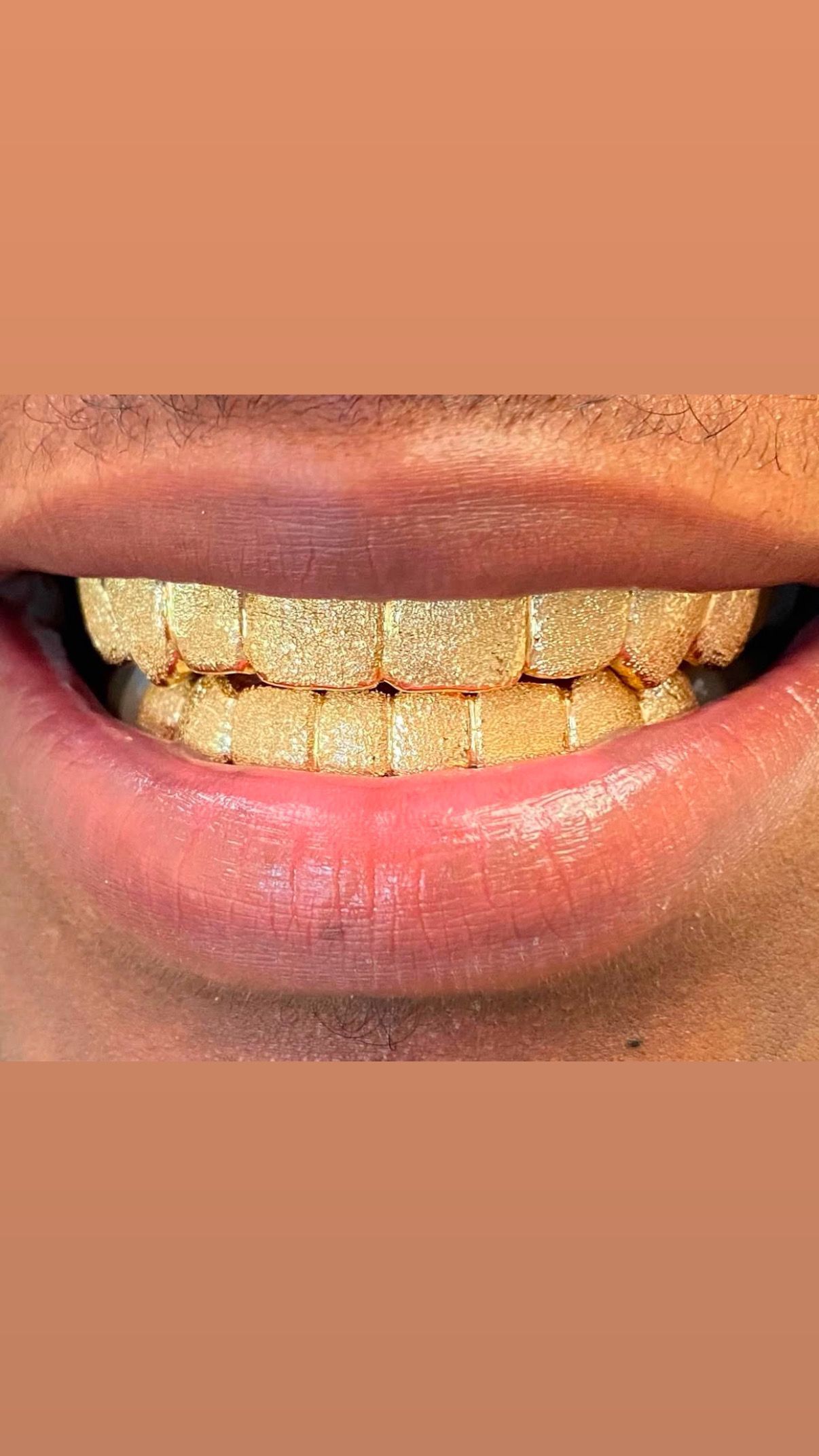 gold grillz