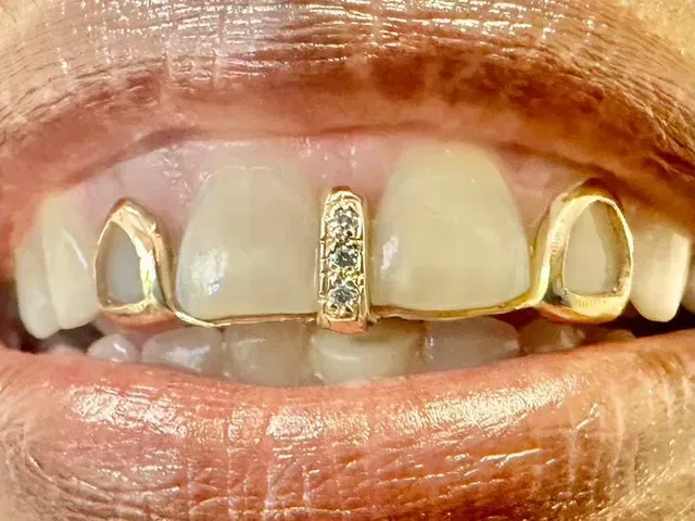personalized grill with diamonds and gold