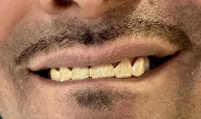 gold grill