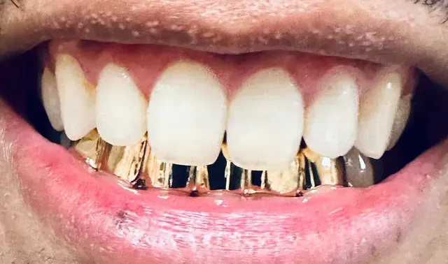 gold bottoms grill