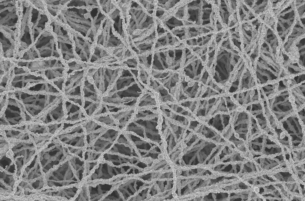 A close up of a spider web under a microscope.