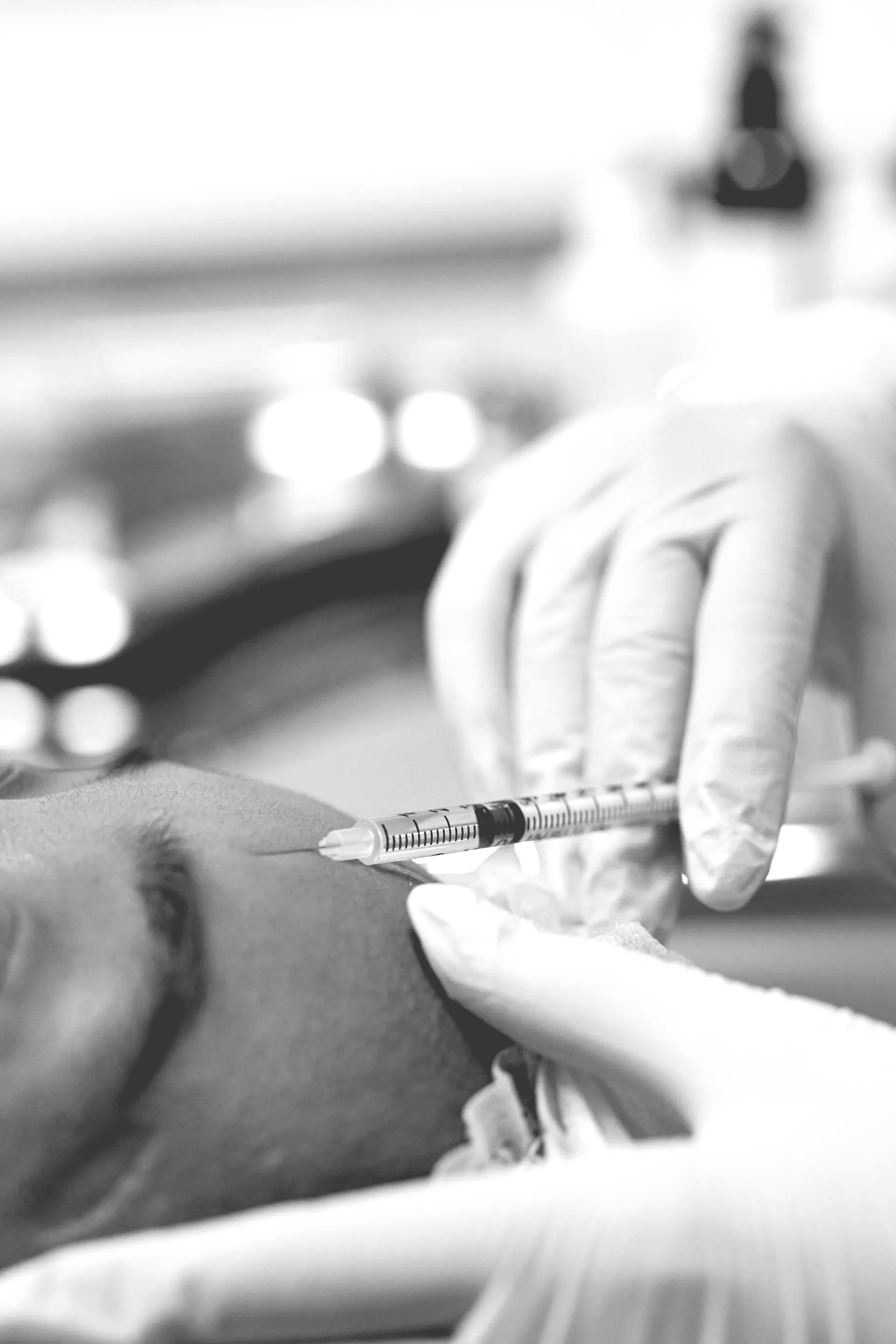 Expert Botox Treatment