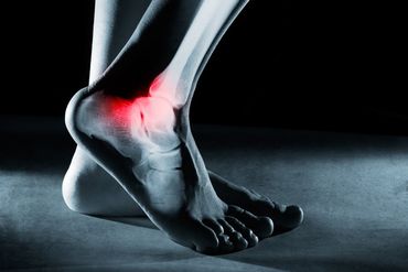 Foot Pain — Fracture Setting in in Portland, OR