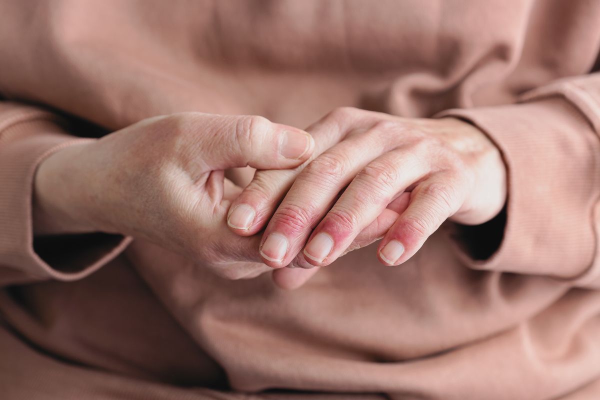 Aprofunde-se na dermatite atópica, uma condição cutânea crônica e hereditária, seus sintomas característicos, e abordagens terapêuticas recomendadas.