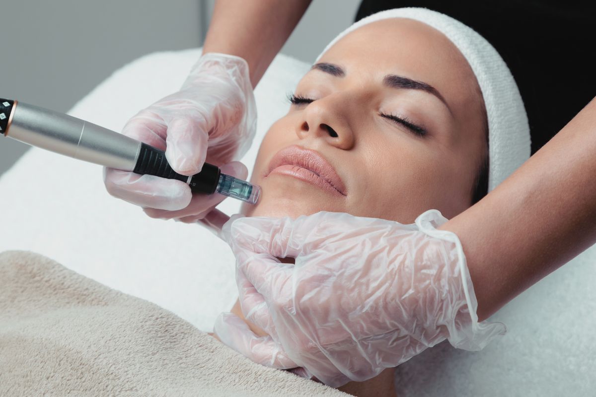 Entenda o microagulhamento, um tratamento inovador que utiliza microagulhas para melhorar a textura e aparência da pele e promover o crescimento capilar.
