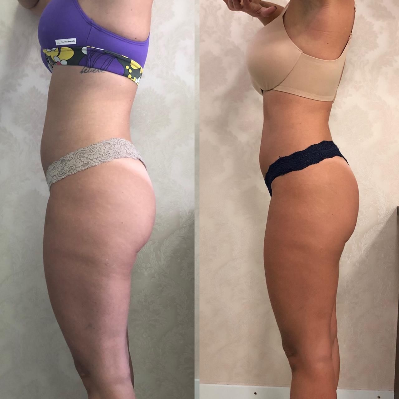 Antes de depois