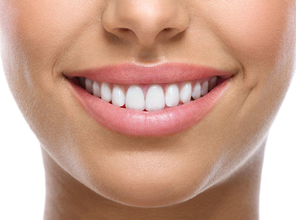 Young Woman with Beautiful Smile — Dental Care in Newcastle, NSW