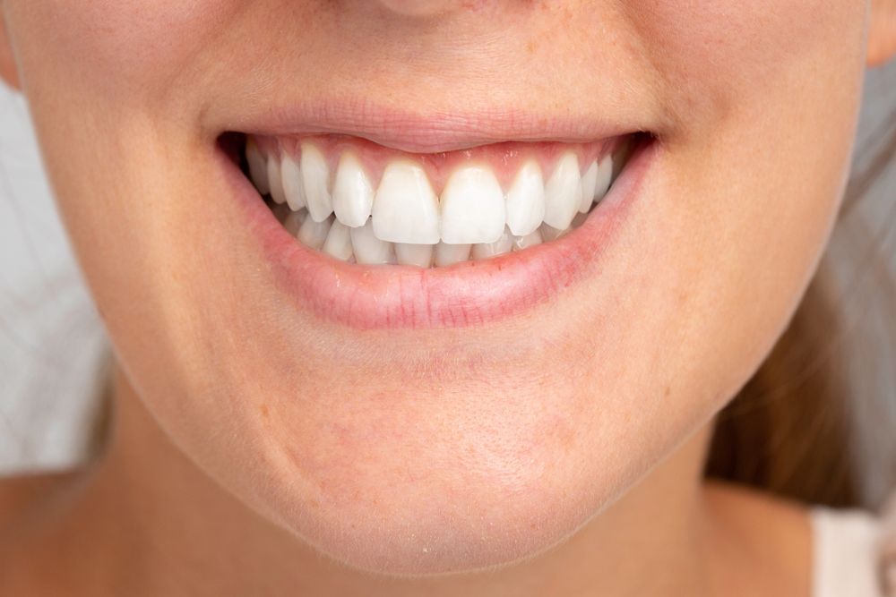 Teeth of A Woman With Dental Care