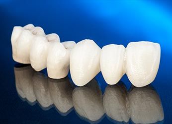 Bridge for Teeth — Dunnellon, FL — Carolina Dentures and General Dentistry