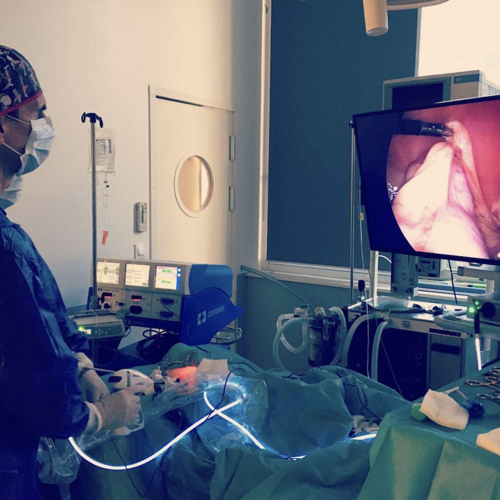Un chirurgien, en salle d'opération, réalise une intervention laparoscopique et visualise les organes internes sur un écran.