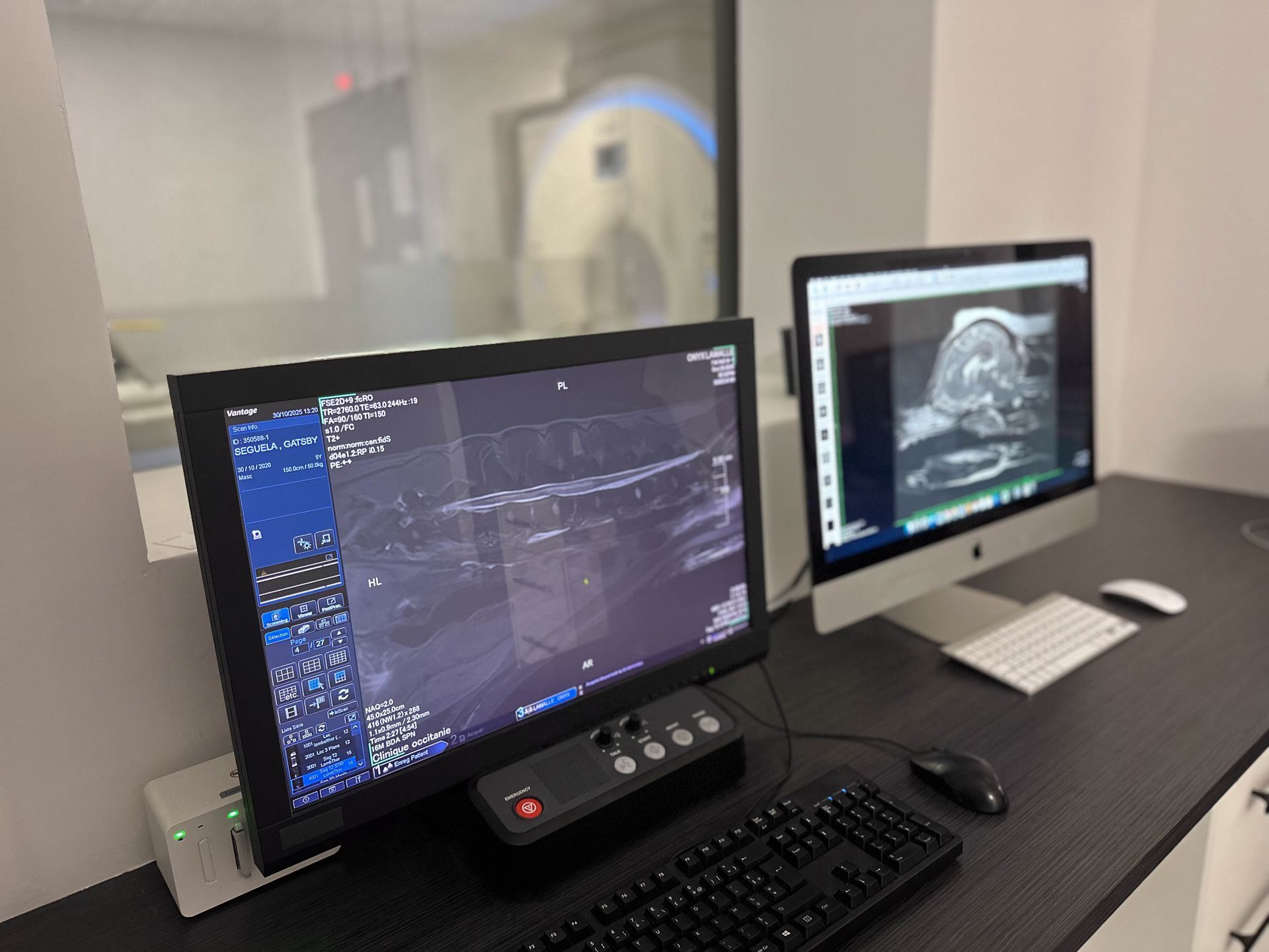 Deux écrans d'ordinateur affichant des images médicales dans une salle de contrôle d'imagerie médicale.