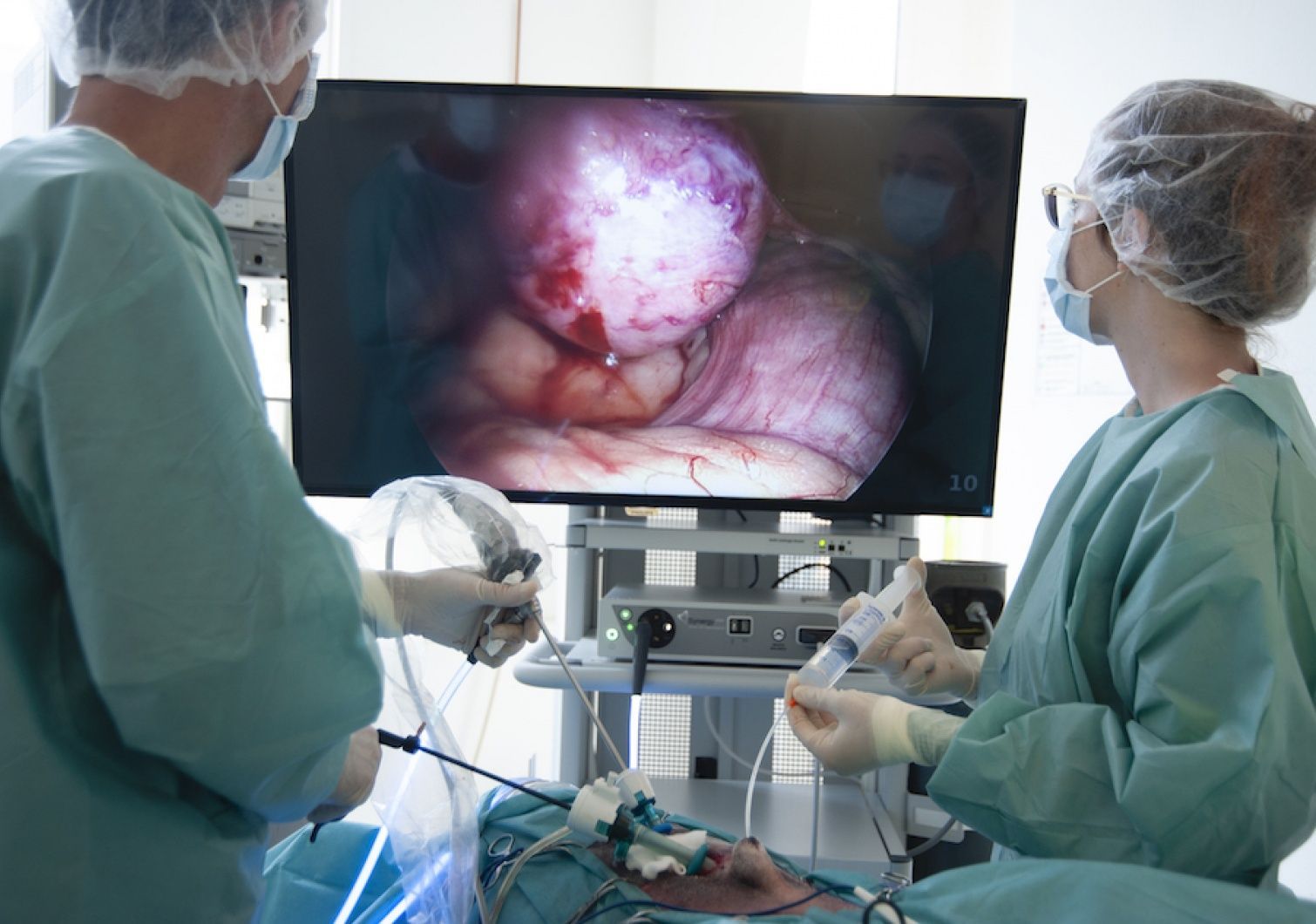 Au cours d'une intervention laparoscopique, les chirurgiens visualisent les organes internes sur un écran dans la salle d'opération.