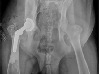 Radiographie du bassin du chien montrant une prothèse de hanche gauche. La hanche droite est également visible.