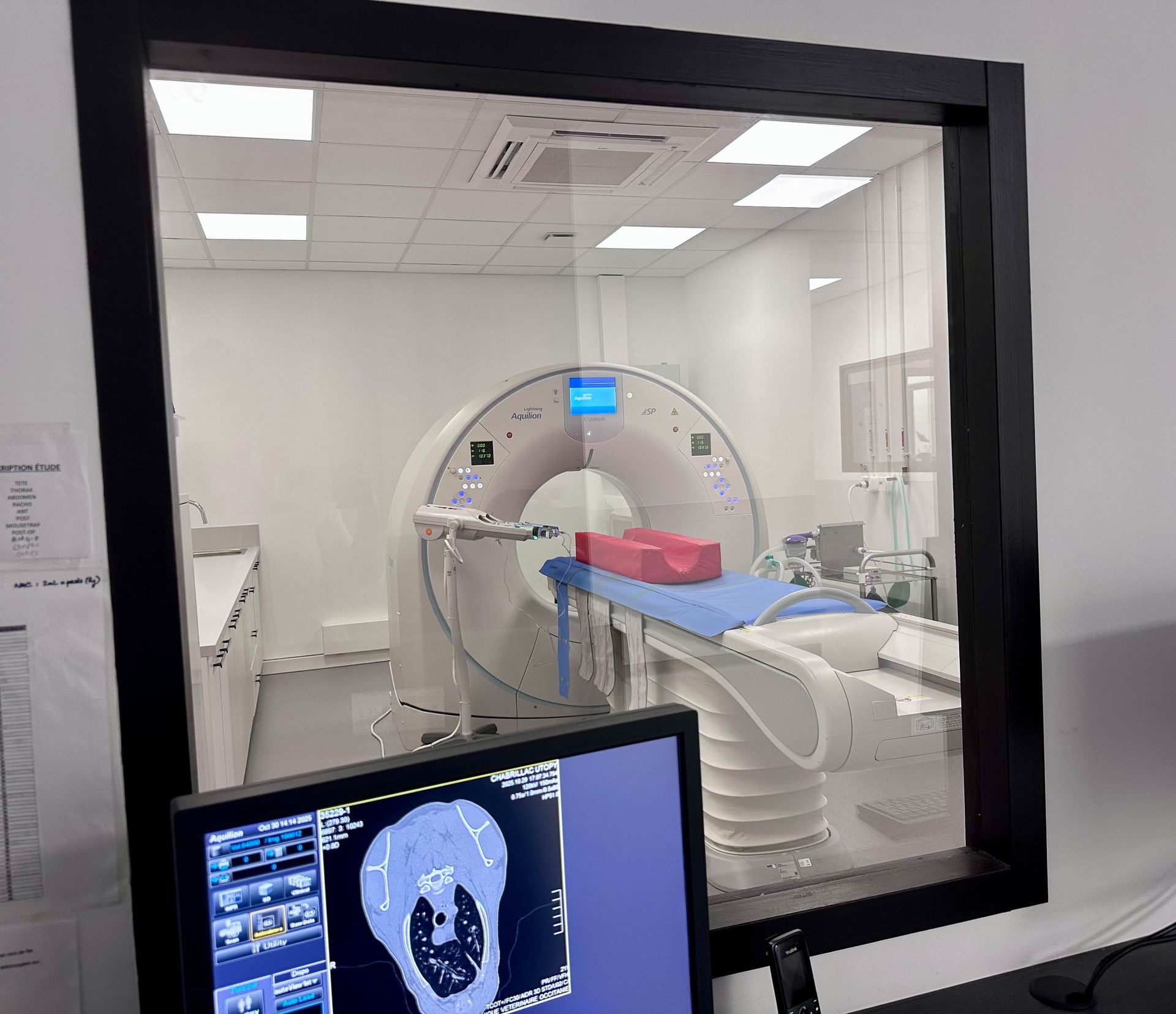 Scanner CT dans une pièce blanche, vu à travers une fenêtre. Un patient est allongé sur la table d'examen, un écran au premier plan.