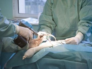 Des chirurgiens opèrent la main d'un patient à l'aide d'instruments chirurgicaux dans une salle d'opération.