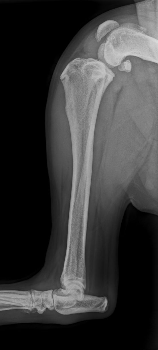 Radiographie d'un bras humain, montrant l'humérus et le coude. Le bras est droit et les os sont visibles.
