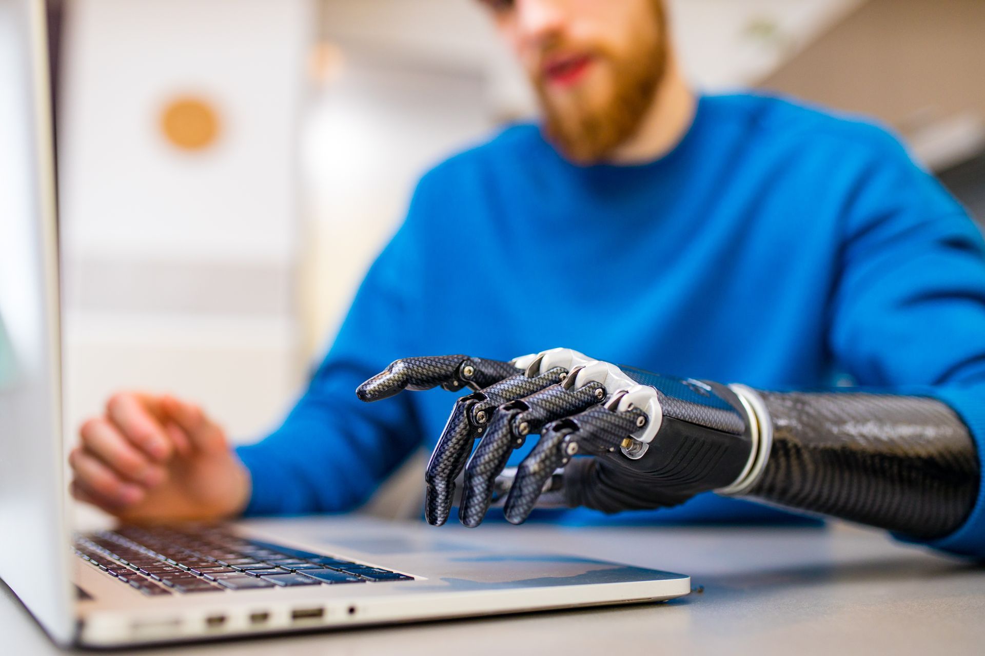 a man with a prosthetic arm is using a laptop, he has received a sales tax exemption